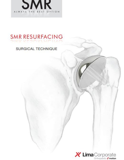 SMR Resurfacing OP Eng